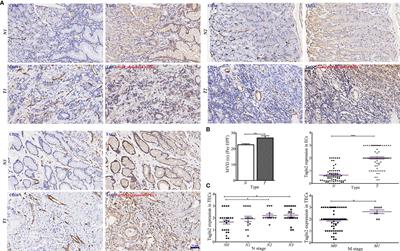 An Essential NRP1-Mediated Role for Tagln2 in Gastric Cancer Angiogenesis